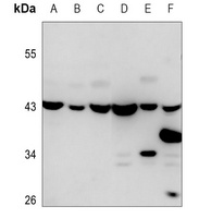 Anti-CLN6 Antibody
