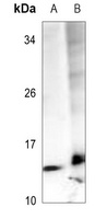 Anti-BRP44 Antibody