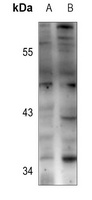 BCL2L12 antibody