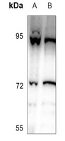 Anti-DDX51 Antibody