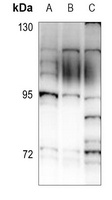 Anti-ALS2CR8 Antibody