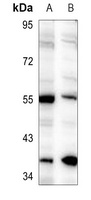 CHRNB1 antibody