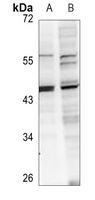 Anti-ABHD12 Antibody