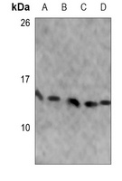 Anti-RPS25 Antibody