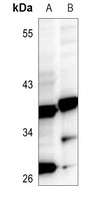 Anti-MRPL44 Antibody