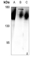 Anti-IL-17RA Antibody