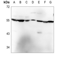 Anti-CDKAL1 Antibody