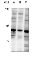 Anti-GTF3C4 Antibody