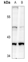 Anti-PRDM12 Antibody