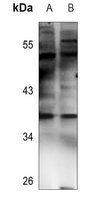 Anti-NT5C3 Antibody
