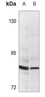 Anti-PGBD1 Antibody