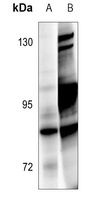 Anti-BRSK1 Antibody