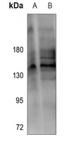 Anti-RGAG1 Antibody