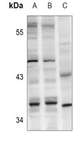 Anti-CTU1 Antibody