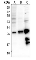 Anti-LDOC1L Antibody