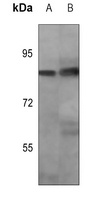 Anti-OCT1 (Phospho-S385) Antibody