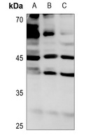 Anti-ROMK1 (Phospho-S44) Antibody