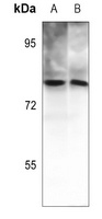 Anti-PKC theta (Phospho-T538) Antibody