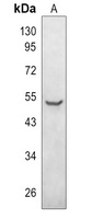 Parkin (phospho-S131) antibody