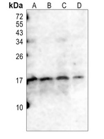 Anti-CD247 (Phospho-Y142) Antibody