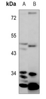 TTC35 antibody