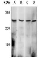 Anti-EPG5 Antibody