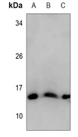 Histone H2A (AcK118) antibody
