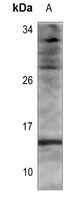 Histone H2B (AcK116) antibody