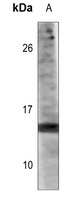 Histone H3 (AcK14) antibody
