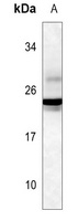 GH1/2 antibody