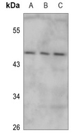 Anti-IRX1 Antibody