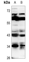 Anti-CD83 Antibody