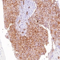 Goat Anti-Rabbit IgG (H&L)-HRP Polymer