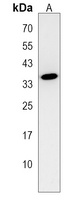 Anti-clvs2 Antibody