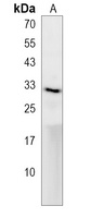 Anti-ak2 Antibody