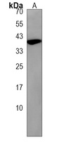 Anti-mc4r Antibody