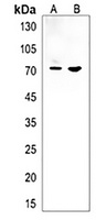 Anti-mtmr14 Antibody