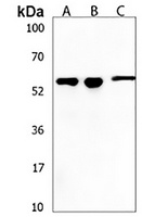 Anti-KLHL20 Antibody