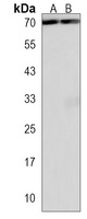 Anti-WDR43 Antibody