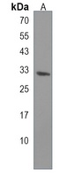 Anti-CRLS1 Antibody