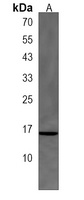 Anti-CRABP1 Antibody