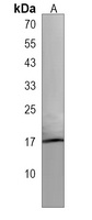 Anti-IFT43 Antibody