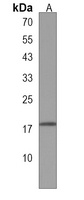 Anti-TRAPPC6A Antibody