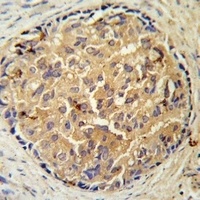SRD5A3 Rabbit Polyclonal Antibody