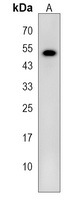 Anti-SCRN1 Antibody