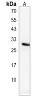 Anti-RSPO2 Antibody