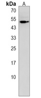 Anti-CNOT6L Antibody