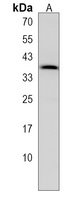 Anti-CMPK2 Antibody