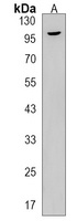 Anti-ACAP3 Antibody