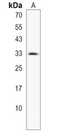 Anti-CCDC101 Antibody